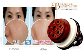 toktok-vibration-cleansing-puff cleansing puff